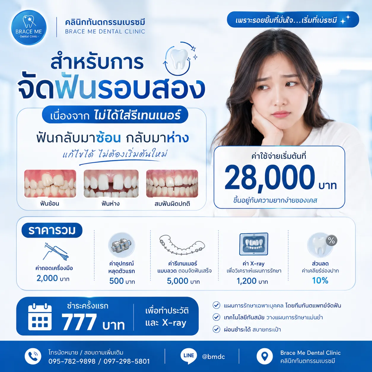 Re-Braces Treatment